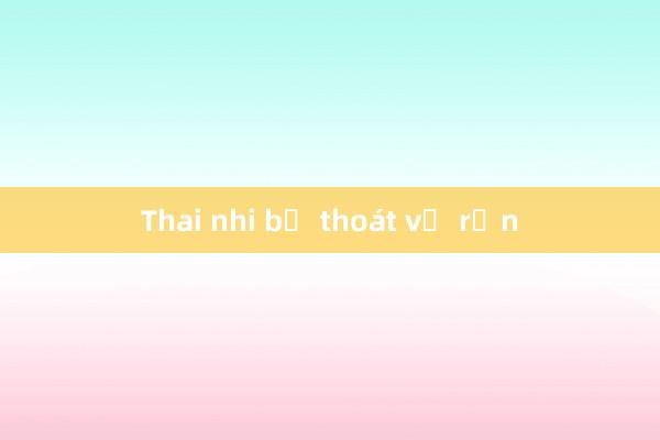 Thai nhi bị thoát vị rốn